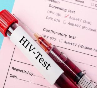 HIV Testing Matters
