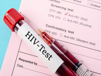 HIV Testing Matters