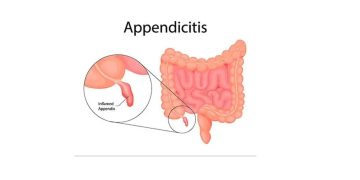Appendicitis
